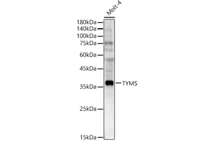 Western Blot - Anti-Thymidylate Synthase Antibody (A11314) - Antibodies.com