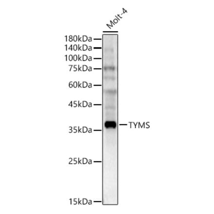 Western Blot - Anti-Thymidylate Synthase Antibody (A11314) - Antibodies.com