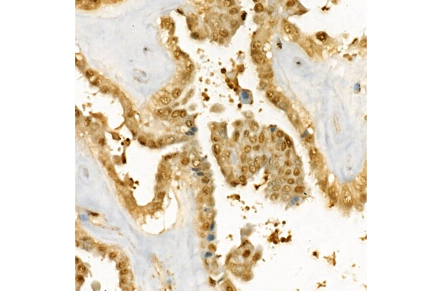 Immunohistochemistry - Anti-Thymidylate Synthase Antibody (A11314) - Antibodies.com