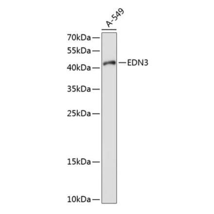 Western Blot - Anti-EDN3 Antibody (A11316) - Antibodies.com