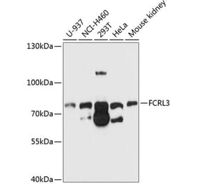 Western Blot - Anti-FCRL3 Antibody (A11317) - Antibodies.com