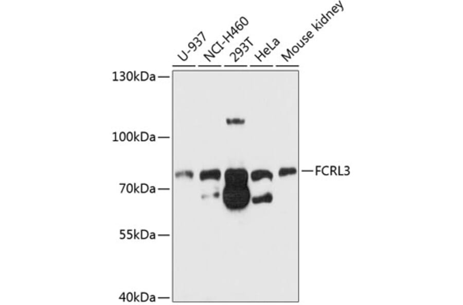 Western Blot - Anti-FCRL3 Antibody (A11317) - Antibodies.com