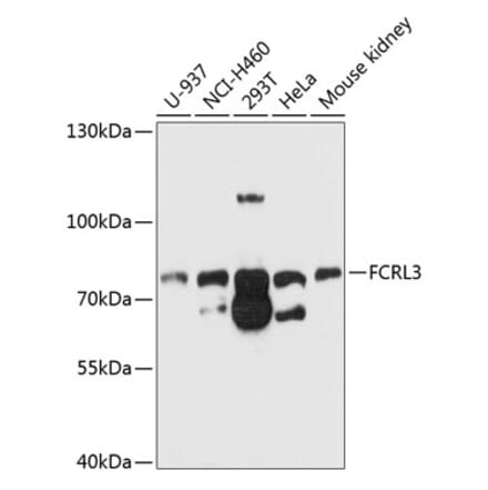 Western Blot - Anti-FCRL3 Antibody (A11317) - Antibodies.com