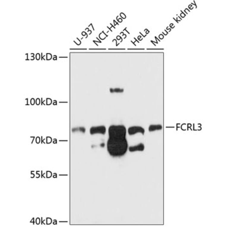 Western Blot - Anti-FCRL3 Antibody (A11317) - Antibodies.com