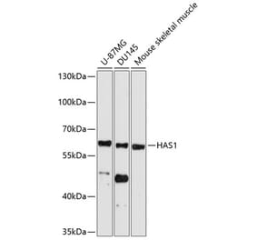 Western Blot - Anti-HAS1 Antibody (A11318) - Antibodies.com