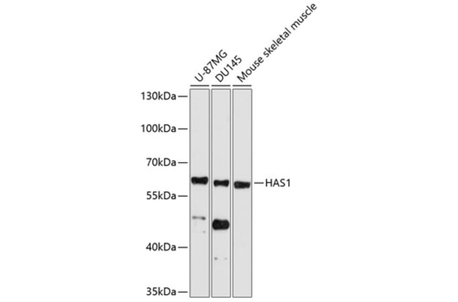 Western Blot - Anti-HAS1 Antibody (A11318) - Antibodies.com