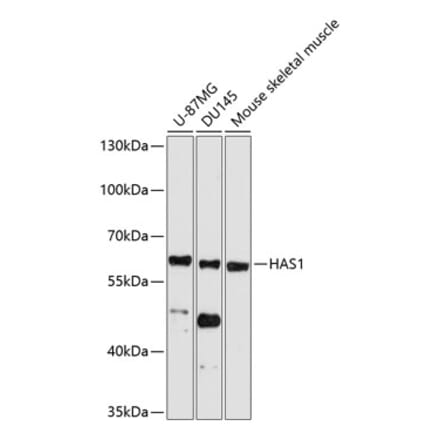 Western Blot - Anti-HAS1 Antibody (A11318) - Antibodies.com