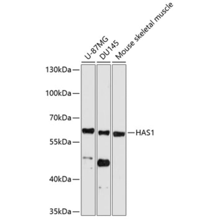 Western Blot - Anti-HAS1 Antibody (A11318) - Antibodies.com