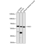 Western Blot - Anti-HAS1 Antibody (A11318) - Antibodies.com