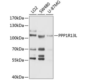 Western Blot - Anti-iASPP Antibody (A11319) - Antibodies.com