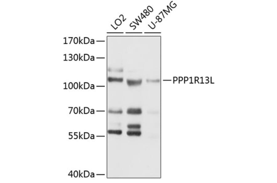 Western Blot - Anti-iASPP Antibody (A11319) - Antibodies.com