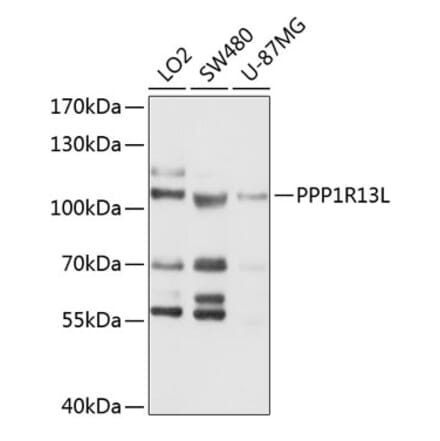 Western Blot - Anti-iASPP Antibody (A11319) - Antibodies.com