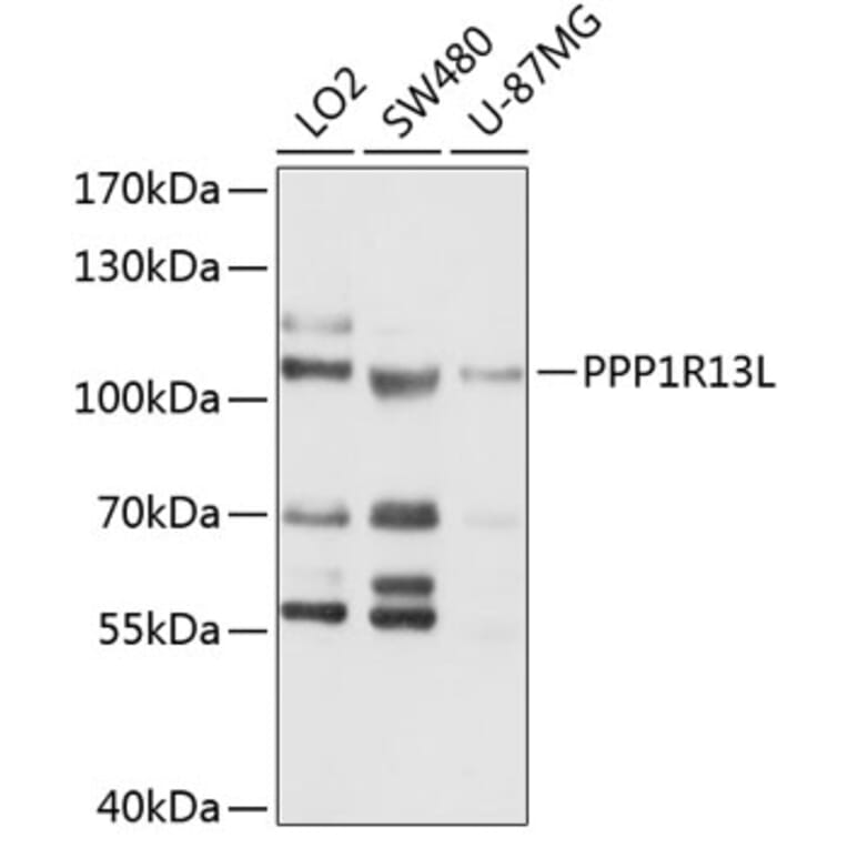 Western Blot - Anti-iASPP Antibody (A11319) - Antibodies.com