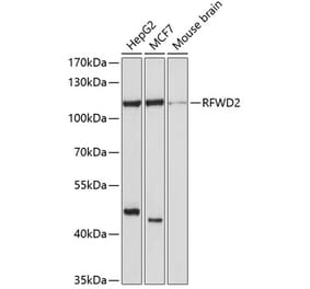 Western Blot - Anti-COP1 Antibody (A11320) - Antibodies.com