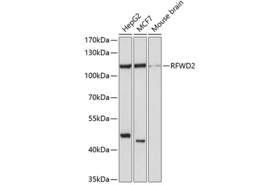 Western Blot - Anti-COP1 Antibody (A11320) - Antibodies.com