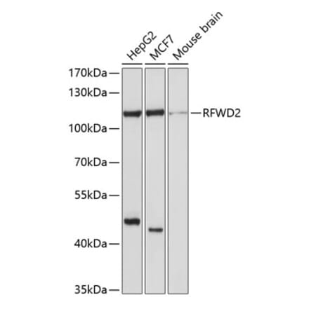 Western Blot - Anti-COP1 Antibody (A11320) - Antibodies.com