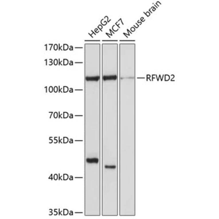 Western Blot - Anti-COP1 Antibody (A11320) - Antibodies.com