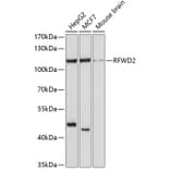 Western Blot - Anti-COP1 Antibody (A11320) - Antibodies.com