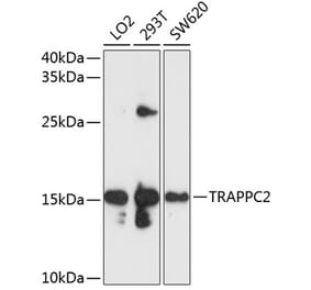 Western Blot - Anti-TRAPPC2 Antibody (A11321) - Antibodies.com