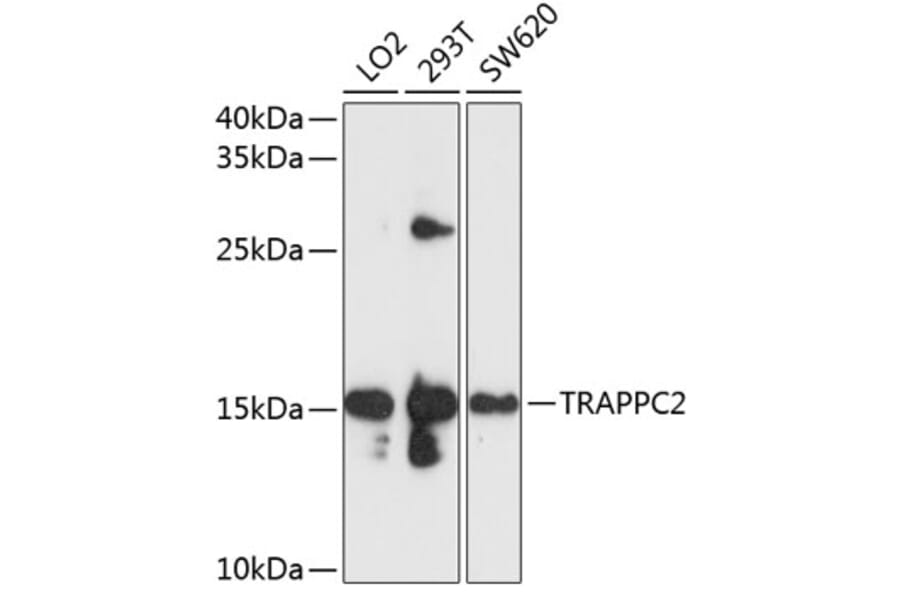 Western Blot - Anti-TRAPPC2 Antibody (A11321) - Antibodies.com