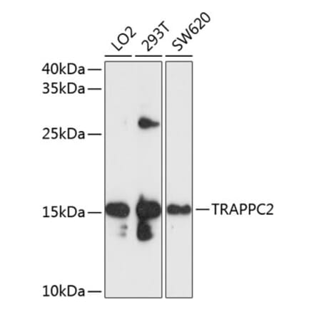 Western Blot - Anti-TRAPPC2 Antibody (A11321) - Antibodies.com