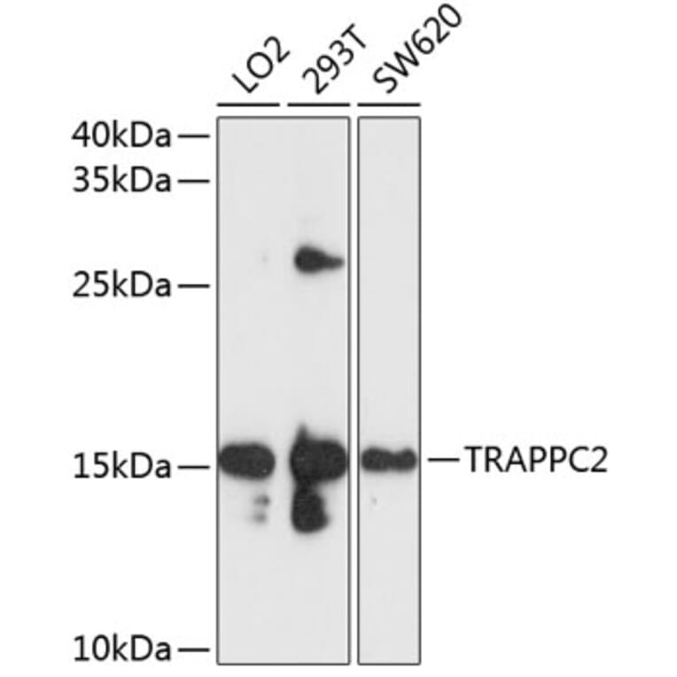 Western Blot - Anti-TRAPPC2 Antibody (A11321) - Antibodies.com