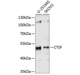 Western Blot - Anti-Cathepsin F Antibody (A11322) - Antibodies.com