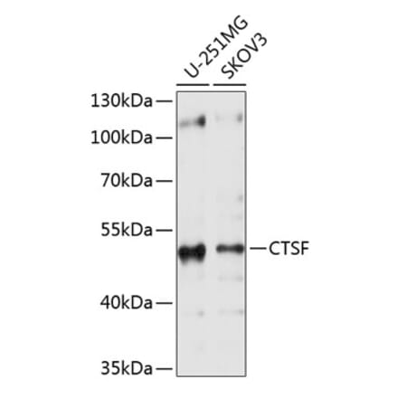 Western Blot - Anti-Cathepsin F Antibody (A11322) - Antibodies.com