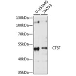 Western Blot - Anti-Cathepsin F Antibody (A11322) - Antibodies.com