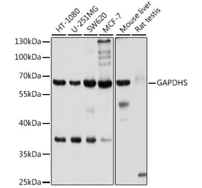 Western Blot - Anti-GAPDS Antibody (A11323) - Antibodies.com