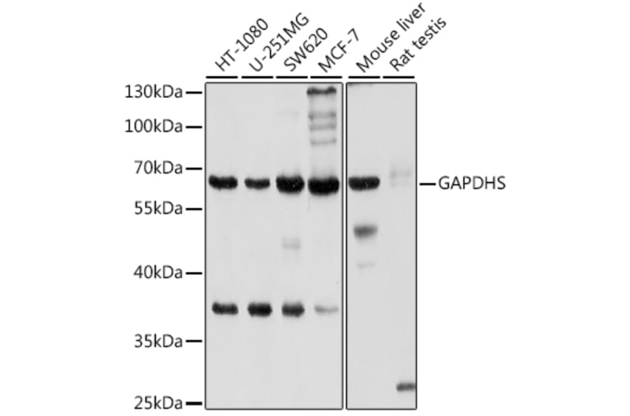 Western Blot - Anti-GAPDS Antibody (A11323) - Antibodies.com