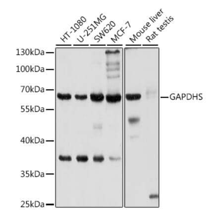 Western Blot - Anti-GAPDS Antibody (A11323) - Antibodies.com