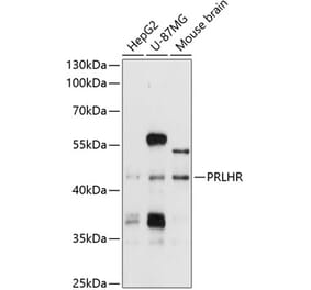 Western Blot - Anti-GPCR GPR10 Antibody (A11324) - Antibodies.com