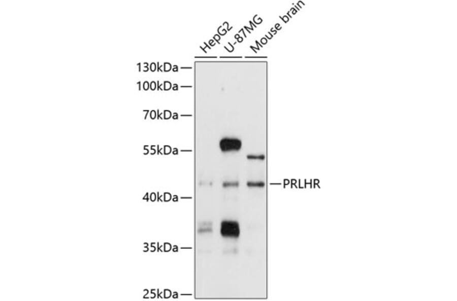 Western Blot - Anti-GPCR GPR10 Antibody (A11324) - Antibodies.com
