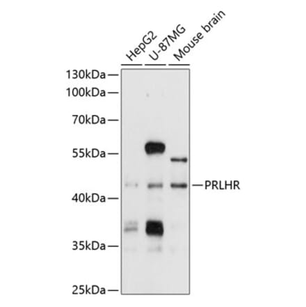 Western Blot - Anti-GPCR GPR10 Antibody (A11324) - Antibodies.com