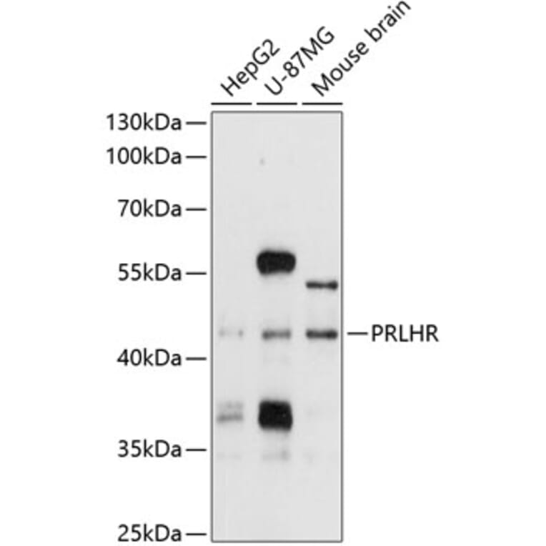 Western Blot - Anti-GPCR GPR10 Antibody (A11324) - Antibodies.com