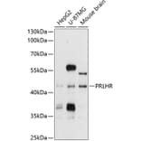 Western Blot - Anti-GPCR GPR10 Antibody (A11324) - Antibodies.com