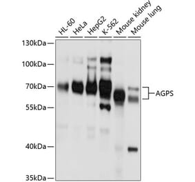 Western Blot - Anti-AGPS Antibody (A11325) - Antibodies.com