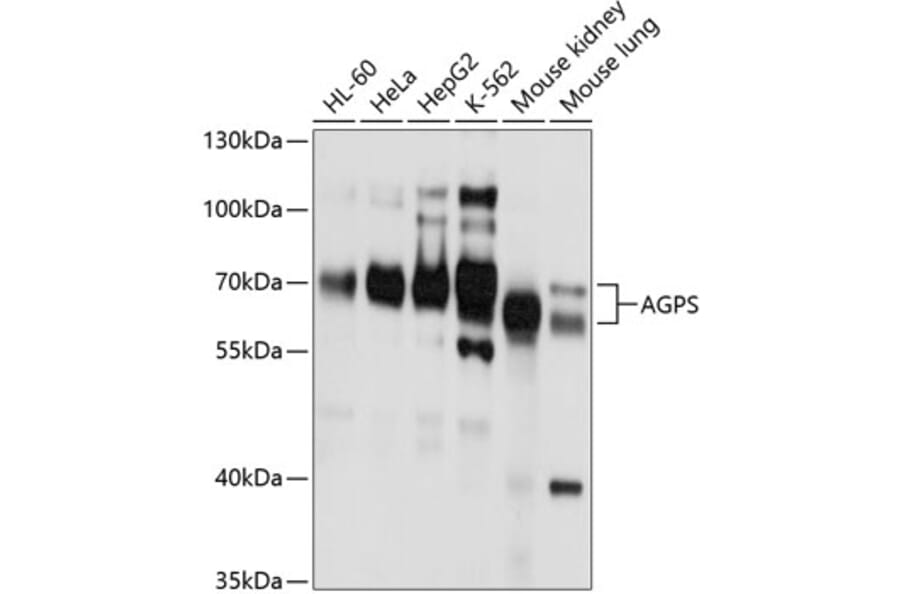 Western Blot - Anti-AGPS Antibody (A11325) - Antibodies.com