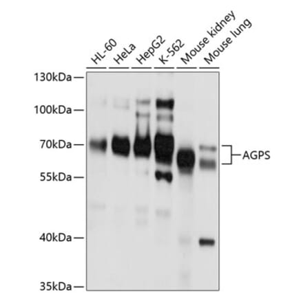 Western Blot - Anti-AGPS Antibody (A11325) - Antibodies.com