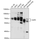 Western Blot - Anti-AGPS Antibody (A11325) - Antibodies.com