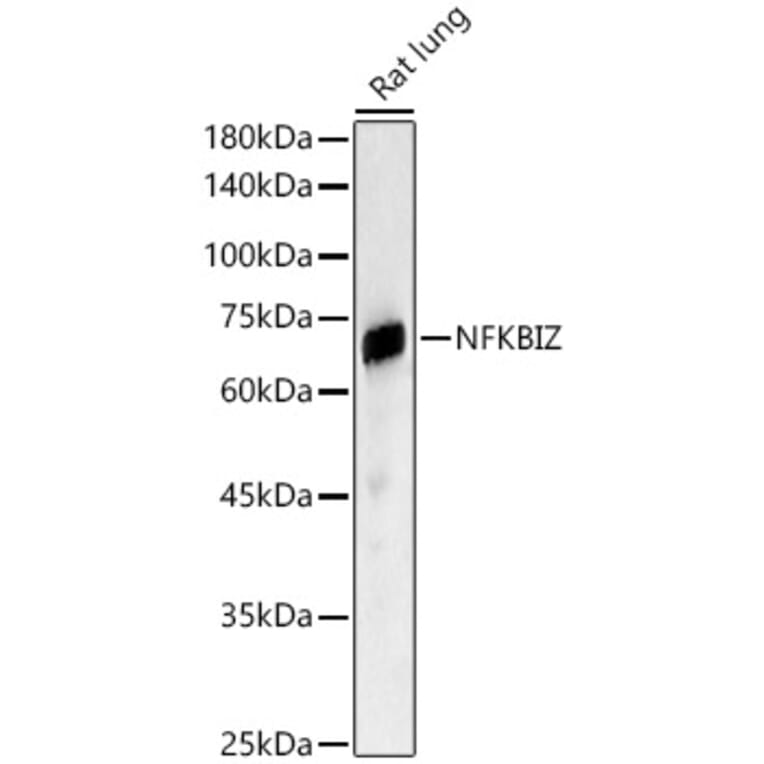 Western Blot - Anti-IKB zeta Antibody (A11326) - Antibodies.com