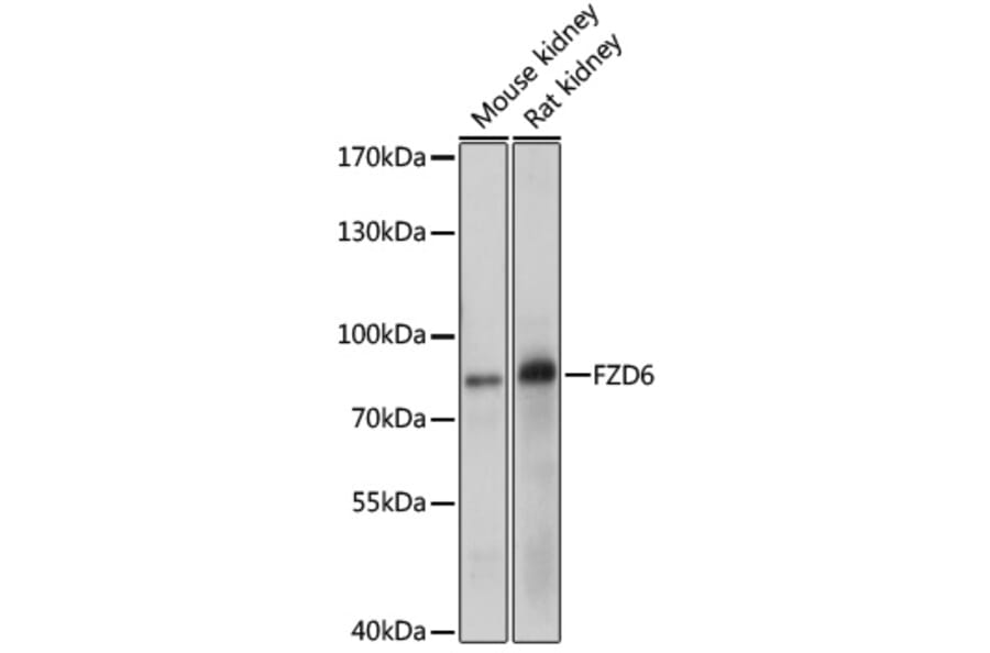 Western Blot - Anti-Frizzled 6 Antibody (A11328) - Antibodies.com