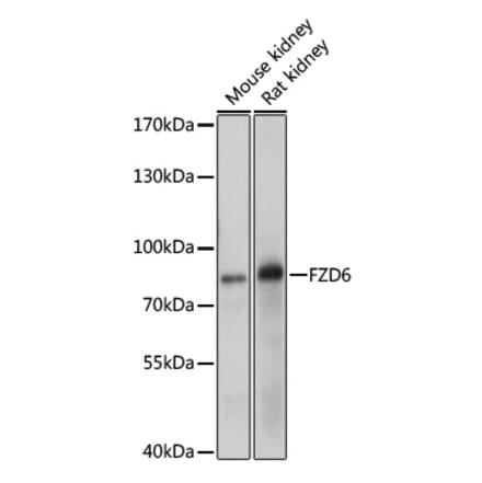 Western Blot - Anti-Frizzled 6 Antibody (A11328) - Antibodies.com