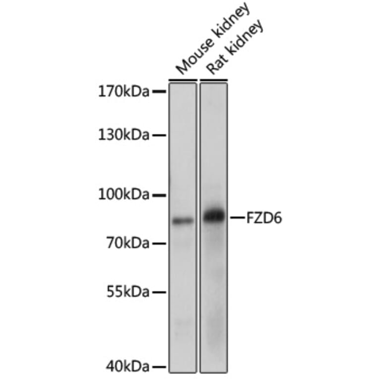 Western Blot - Anti-Frizzled 6 Antibody (A11328) - Antibodies.com