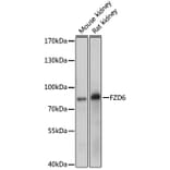 Western Blot - Anti-Frizzled 6 Antibody (A11328) - Antibodies.com