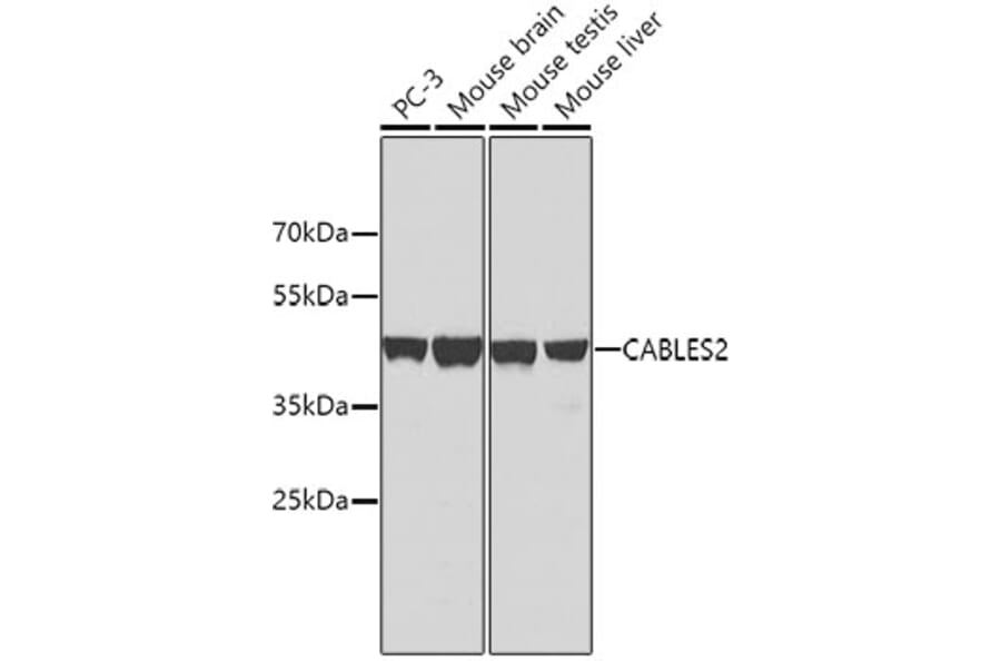 Western Blot - Anti-CABLES2 Antibody (A10525) - Antibodies.com