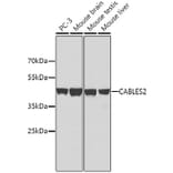 Western Blot - Anti-CABLES2 Antibody (A10525) - Antibodies.com