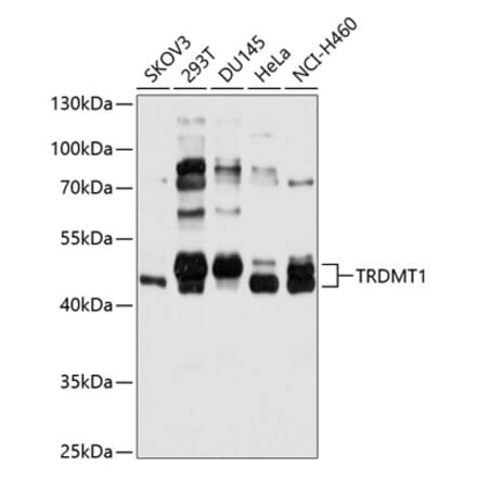 Western Blot - Anti-Dnmt2 Antibody (A11330) - Antibodies.com