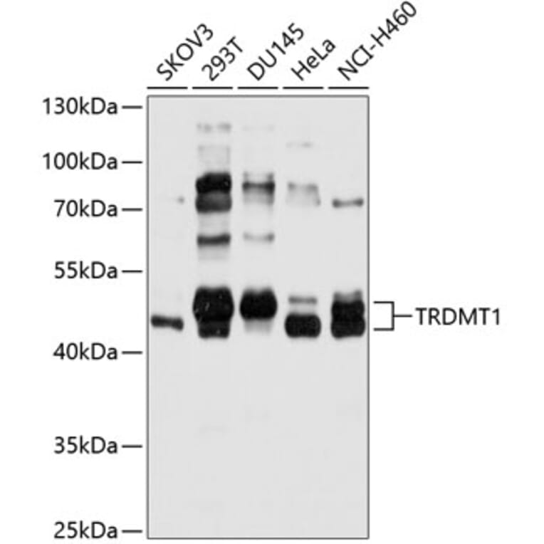 Western Blot - Anti-Dnmt2 Antibody (A11330) - Antibodies.com